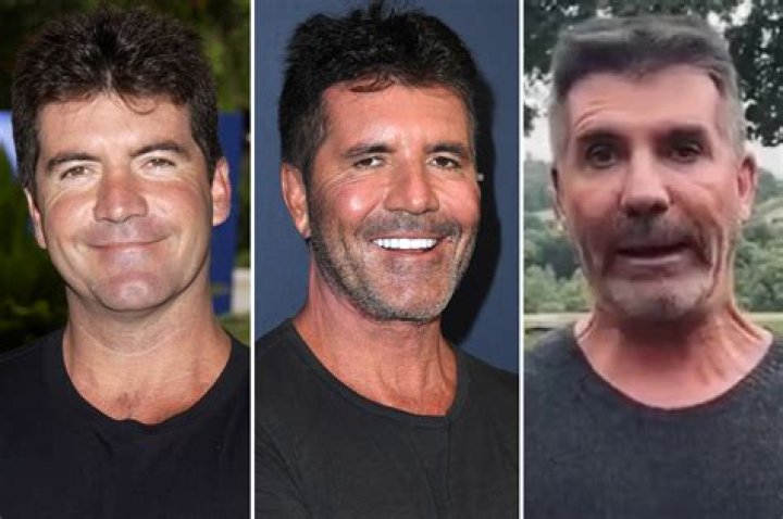 BGT fans are all asking what happened to Simon Cowell's eye