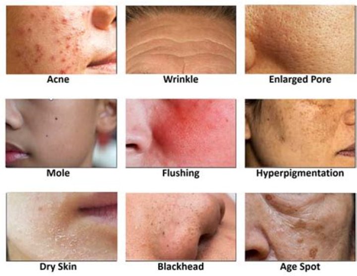 Charlie Woods' Skin Condition And Disappearance