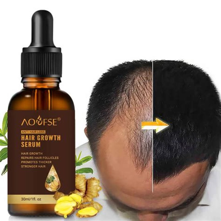 Hair Growth Oil for Thick Hair: Unlocking the Secrets to Luxurious Locks
