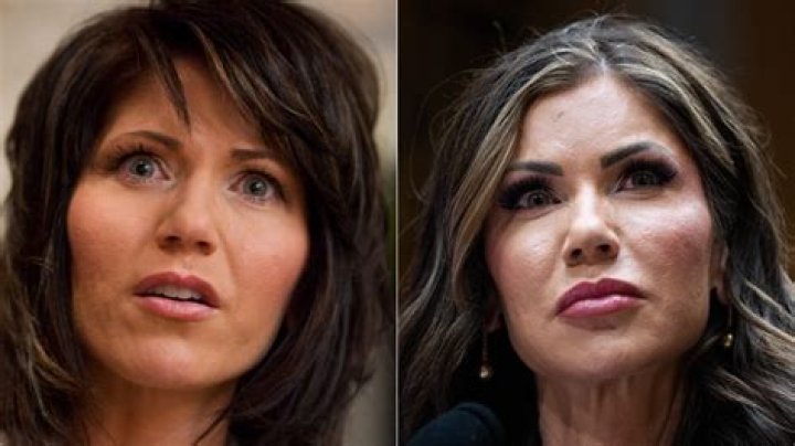 Inside Kristi Noem's "Before And After"