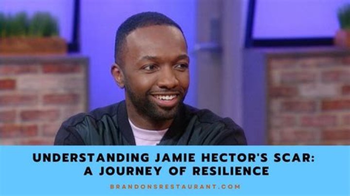 Jamie Hector Scar: The Untold Story Behind the Iconic Mark
