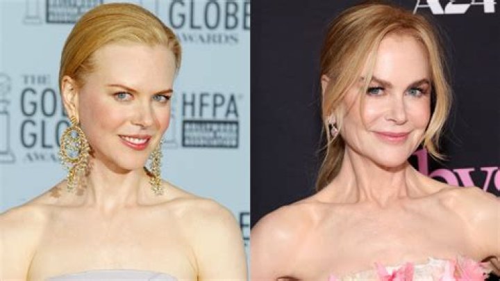Nicole Kidman's Plastic Surgery Journey Explored