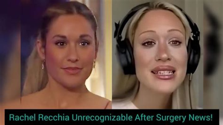 Rachel Bachelorette Breast Surgery: A Comprehensive Insight