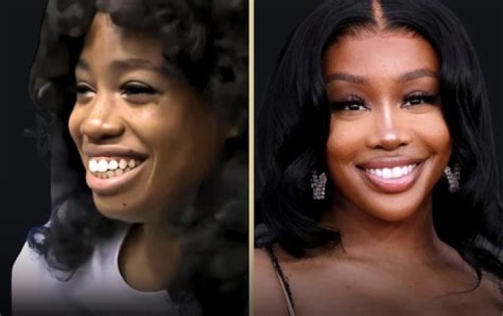 SZA Nose: A Comprehensive Look into Her Distinctive Feature