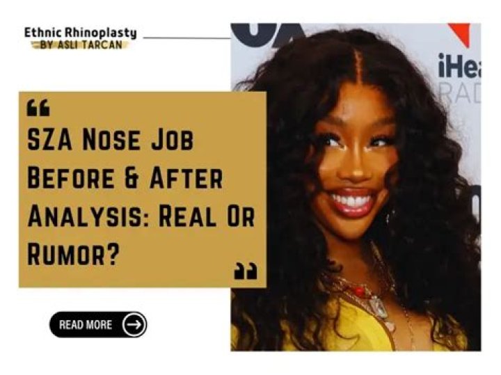 SZA Nose Job: The Truth Behind the Rumors and Transformations